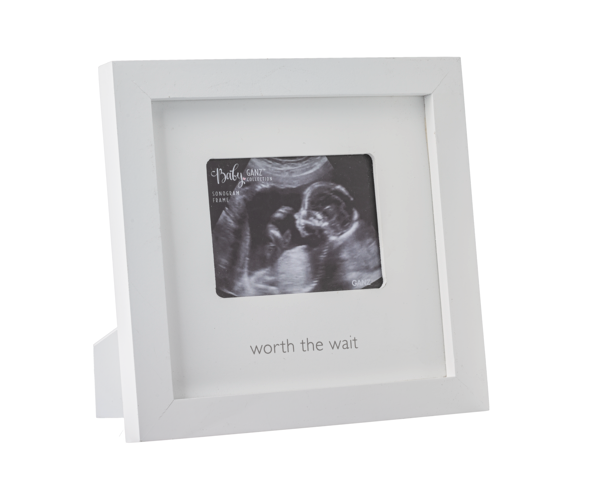 Ganz Sonogram Frames